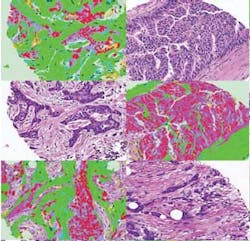 1202vsd Snap Cancer 1202vsd Snap Cancer