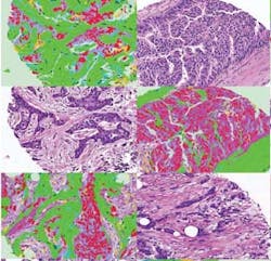 1202vsd Snap Cancer 1202vsd Snap Cancer