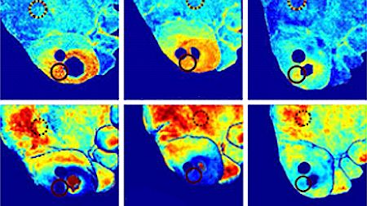 Hyperspectral imaging helps diagnose ulcers
