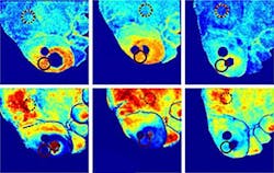 Hyperspectral imaging helps diagnose ulcers Hyperspectral imaging helps diagnose ulcers
