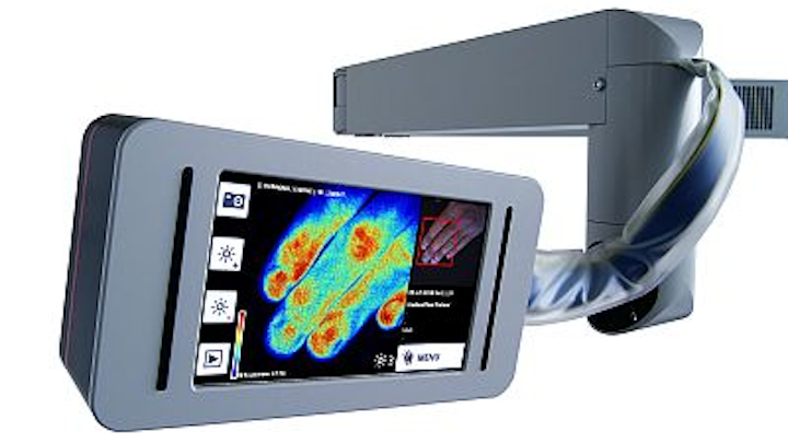 Laser-based imager determines severity of burns