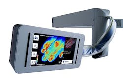 Laser-based imager determines severity of burns Laser-based imager determines severity of burns