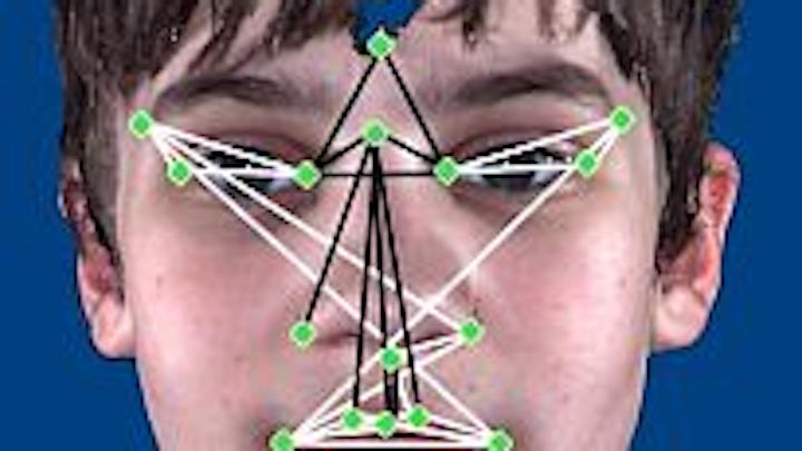 3-D camera helps identify autistic differences