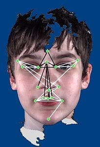3-D camera helps identify autistic differences