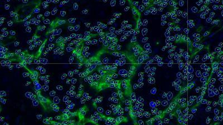 An automated image-analysis software toolkit called Farsight (Fluorescence Association Rules for Quantitative Insight) identifies cancer cells based on a subset of examples