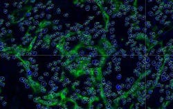 An automated image-analysis software toolkit called Farsight (Fluorescence Association Rules for Quantitative Insight) identifies cancer cells based on a subset of examples An automated image-analysis software toolkit called Farsight (Fluorescence Association Rules for Quantitative Insight) identifies cancer cells based on a subset of examples