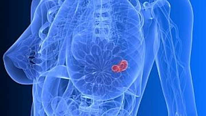 Micrima develops the MARIA (Multistatis Array processing for Radiowave Image Acquisition) system to capture 3-D images of breast tumors