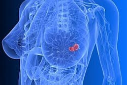 Micrima develops the MARIA (Multistatis Array processing for Radiowave Image Acquisition) system to capture 3-D images of breast tumors Micrima develops the MARIA (Multistatis Array processing for Radiowave Image Acquisition) system to capture 3-D images of breast tumors