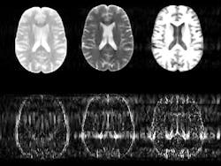 An image-processing algorithm developed at MIT helps to reduce MRI scanning time by predicting the likely position of tissue boundaries in subsequent scans