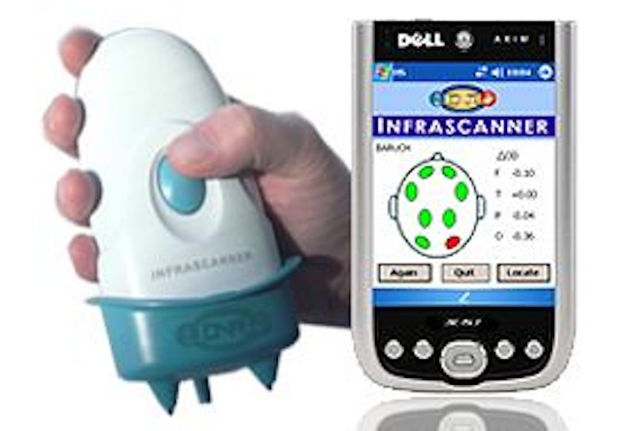 Infrascanner uses near-infrared light absorption measurements to detect intracranial hematomas
