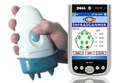 Infrascanner uses near-infrared light absorption measurements to detect intracranial hematomas Infrascanner uses near-infrared light absorption measurements to detect intracranial hematomas