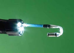 Retroscope images behind the folds of the colon wall during a colonoscopy Retroscope images behind the folds of the colon wall during a colonoscopy