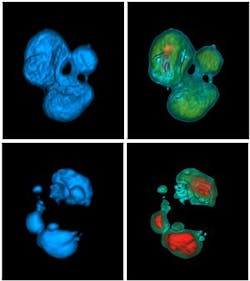 Cell-CT scanner from VisionGate is under investigation under investigation at the Biodesign Institute at Arizona State University for its potential to speed up cancer diagnoses Cell-CT scanner from VisionGate is under investigation under investigation at the Biodesign Institute at Arizona State University for its potential to speed up cancer diagnoses
