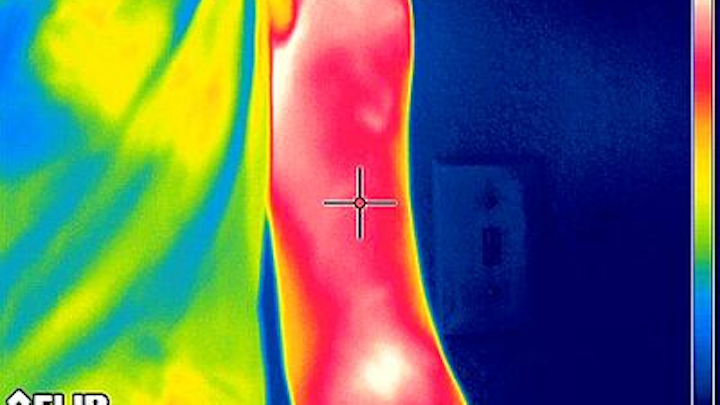Scientists from Loma Linda and Asuza Pacific Universities have employed thermal imaging to help in quantifying muscle soreness. (Source: The Journal of Visualized Experiments)