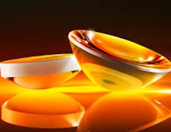 Machine vision market grows five per cent Machine vision market grows five per cent