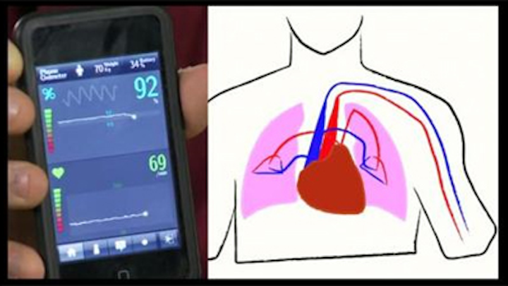 Cell phone helps diagnose pneumonia