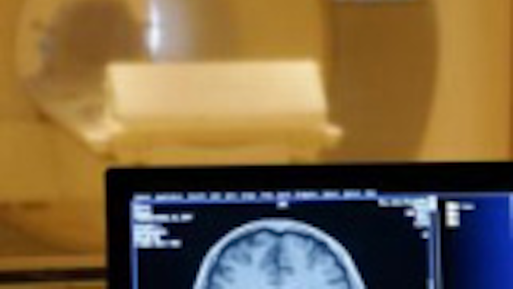 Imaging technique detects brain cancer
