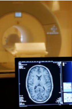 Imaging technique detects brain cancer Imaging technique detects brain cancer