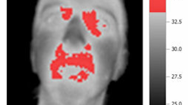 Thermal cameras capture temperature rise during social interactions