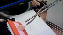 3-D vision system automatically tracks anatomical structures 3-D vision system automatically tracks anatomical structures