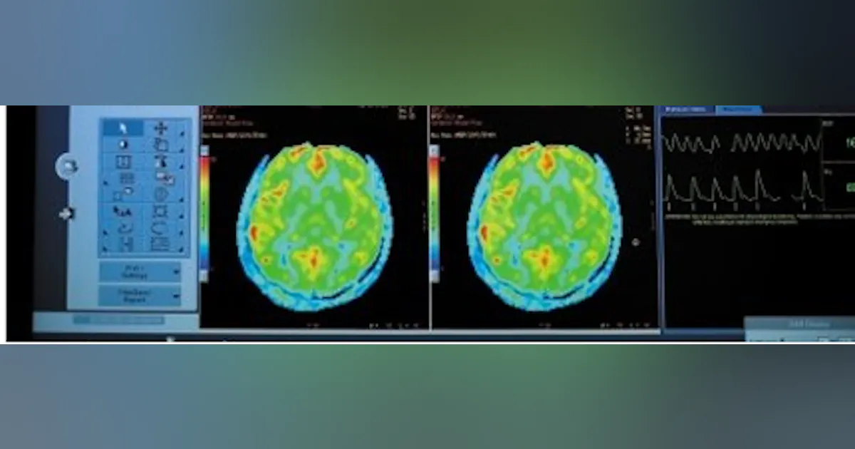 Mri Control Map MRI maps the development of the brain | Vision Systems Design