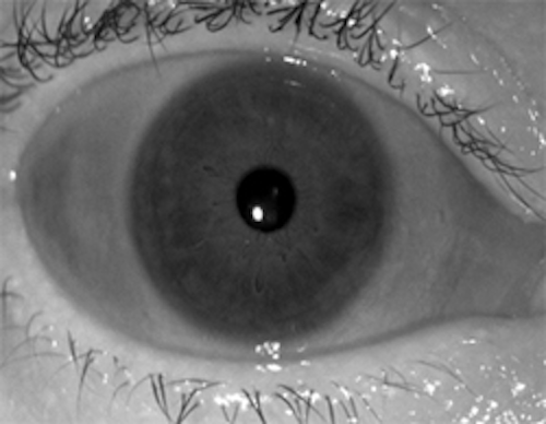 Iris aging raises issues about recognition accuracy
