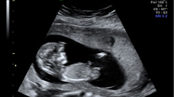 3-D ultrasound software company spins out of Oxford