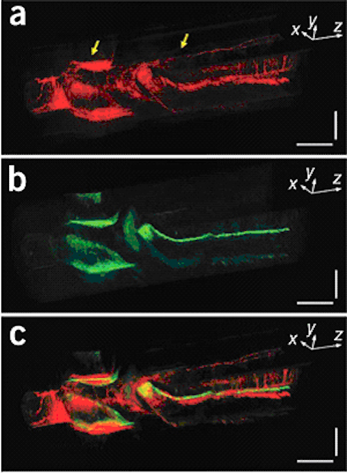 Imaging combination delivers high-contrast, high-resolution images
