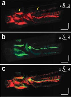 Imaging combination delivers high-contrast, high-resolution images Imaging combination delivers high-contrast, high-resolution images