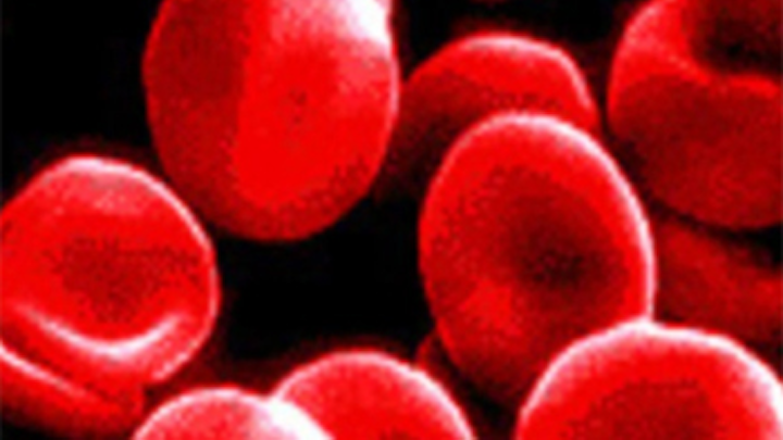 Image processing system determines cholesterol levels in the blood