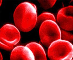 Image processing system determines cholesterol levels in the blood Image processing system determines cholesterol levels in the blood