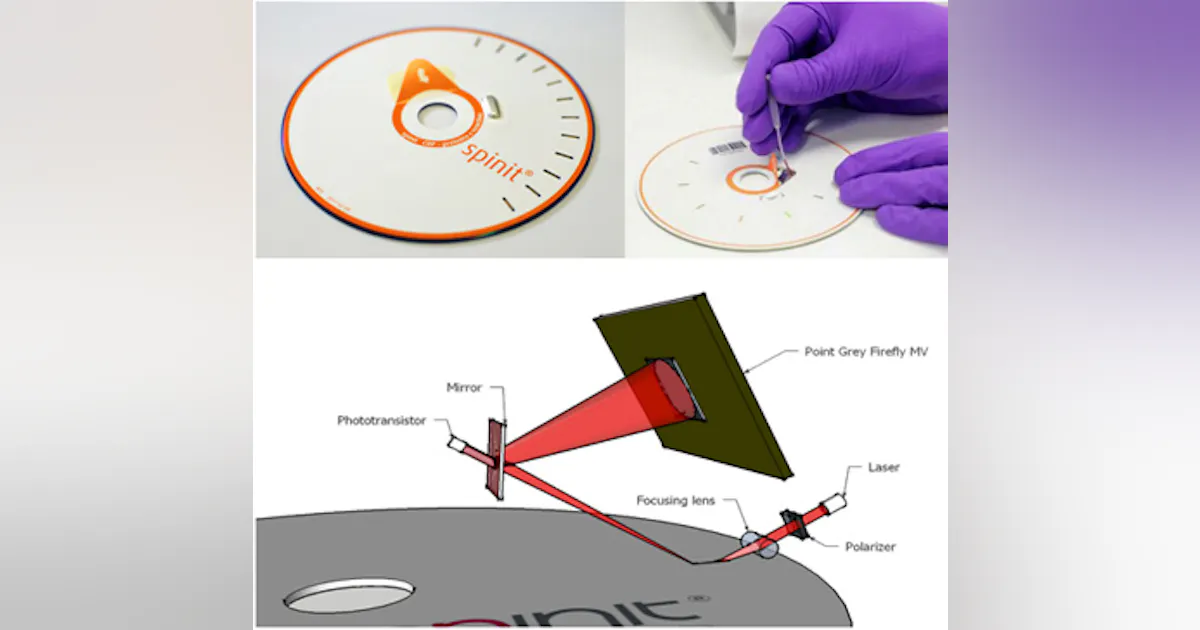 Visual Blood Testing Vision-based blood test system delivers results in 15 minutes | Vision ...