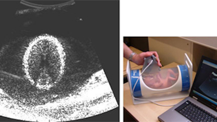 UK engineers develop low-cost ultrasound system