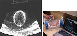 UK engineers develop low-cost ultrasound system UK engineers develop low-cost ultrasound system