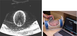 UK engineers develop low-cost ultrasound system