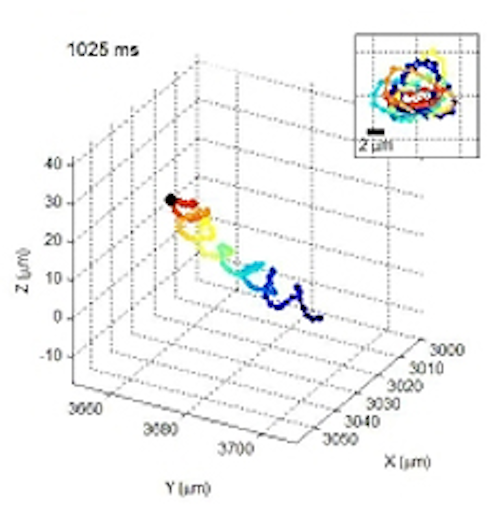 Imaging system captures movement of human sperm