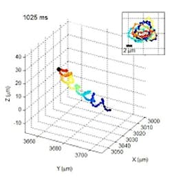 Imaging system captures movement of human sperm Imaging system captures movement of human sperm