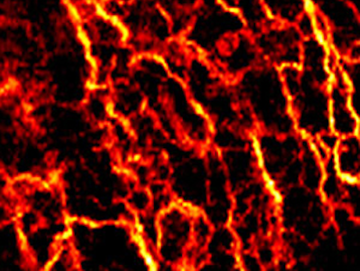 Imaging system gets under the skin