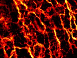 Imaging system gets under the skin Imaging system gets under the skin