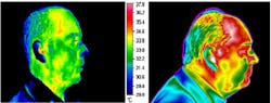 Thermal imaging makes a move into medicine Thermal imaging makes a move into medicine