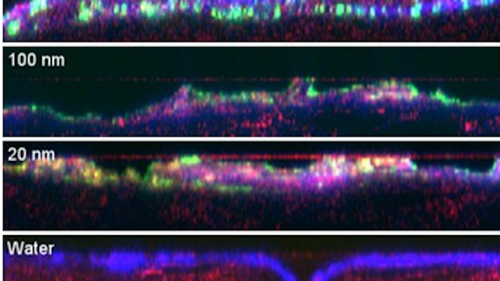 Imaging technique shows nanoparticles do not penetrate skin