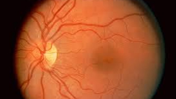 Hand held instrument inspects the retina