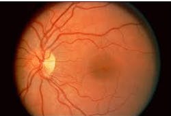 Hand held instrument inspects the retina Hand held instrument inspects the retina