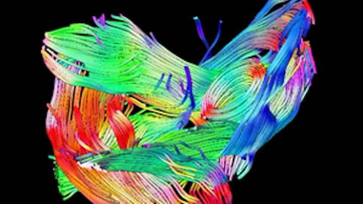 MRI system images muscles in 3-D