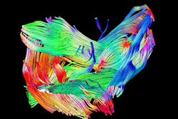 MRI system images muscles in 3-D