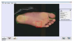 Software monitors foot conditions