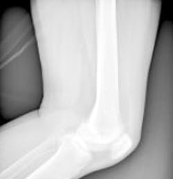 UK researchers to shrink MRI system UK researchers to shrink MRI system