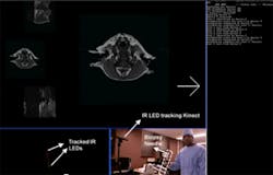 Kinect system helps doctors review records Kinect system helps doctors review records