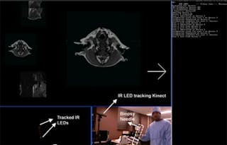 Kinect system helps doctors review records
