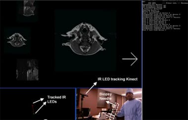 Kinect system helps doctors review records